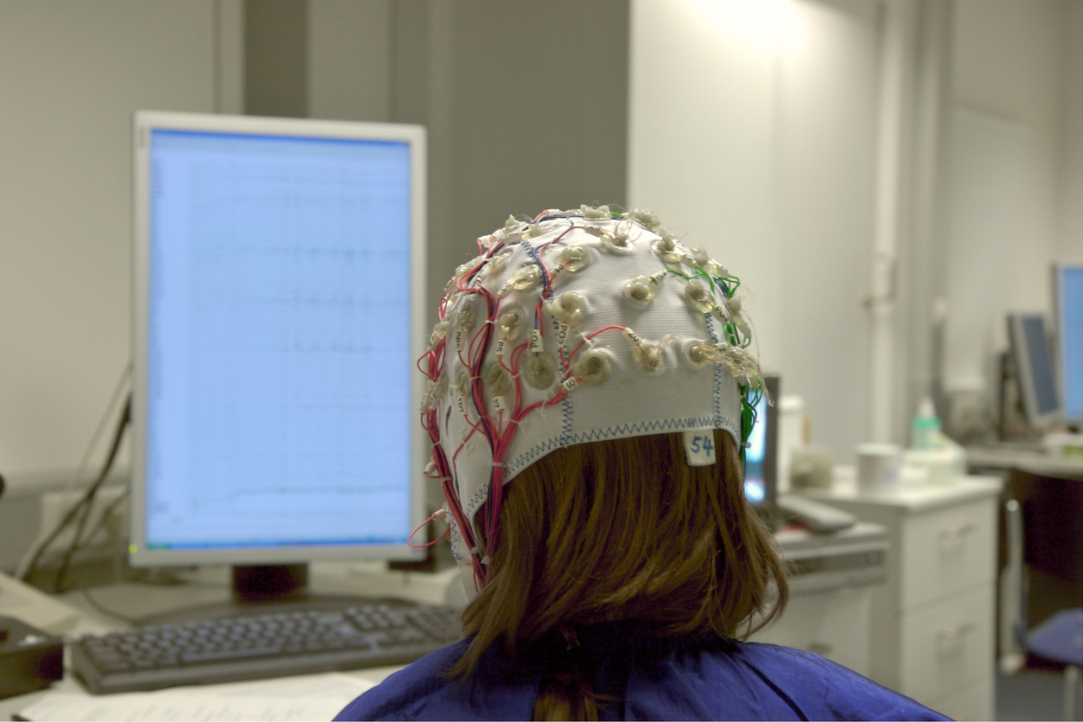 Electrical Brain Stimulation Helps Memorise New Words